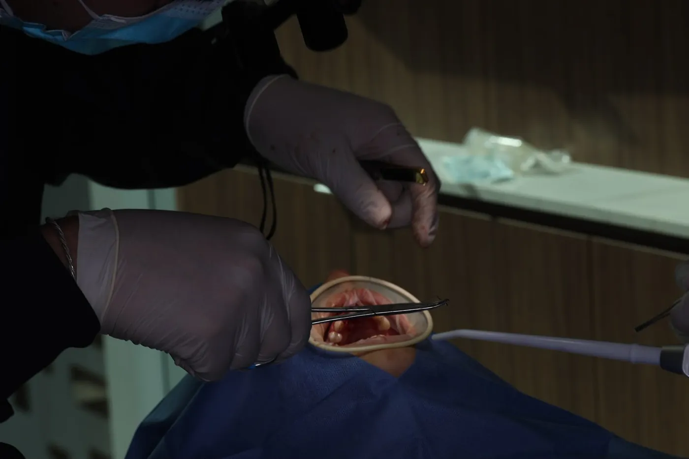 Procedimiento dental de precisión